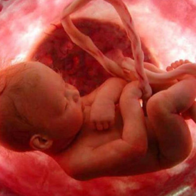 Timeline: Sistema Urogenital