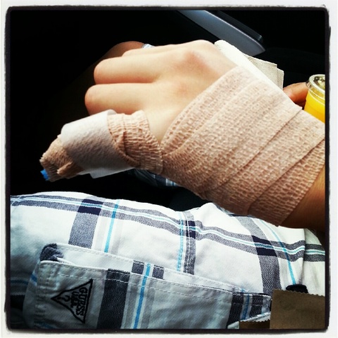 Broke My First Bone Ever