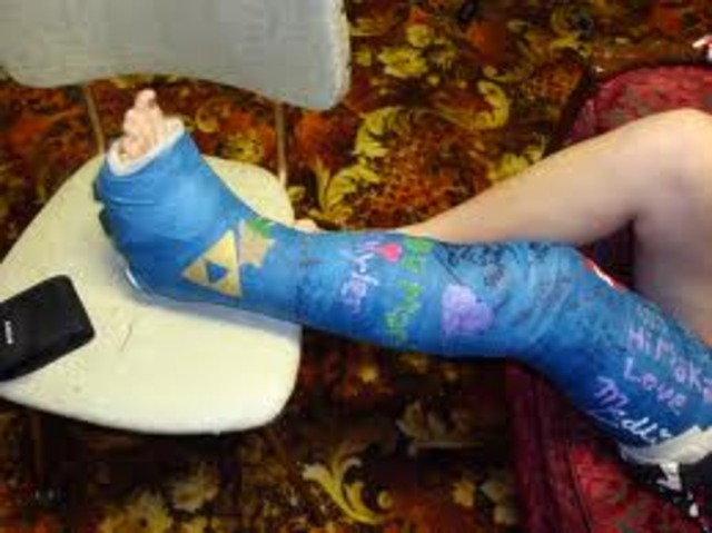 Got a cast and had to wear one for a few years