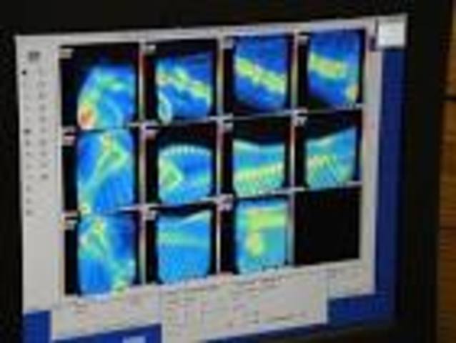 Nuclear scintigraphy used to diagnose lameness
