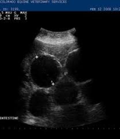 Ultra-sound is emerging technology