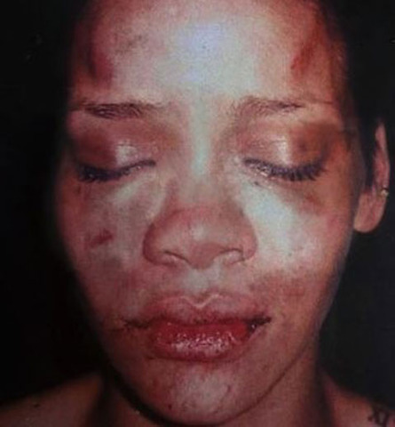 Chris Brown beats Rihanna