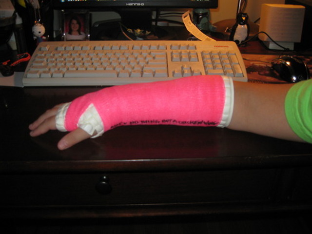 Broke my arm