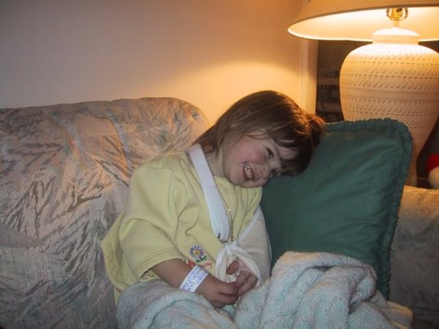 2 - I broke my arm