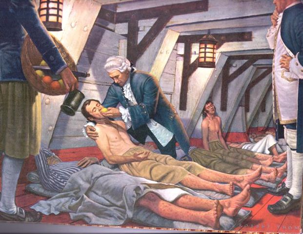 James Lind and trial for scurvy