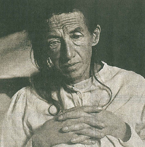 First person to be diagnosed with Alzheimer's