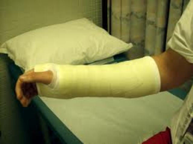 Broke wrist