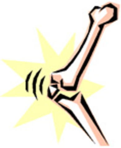 ME DISLOCO EL HOMBRO