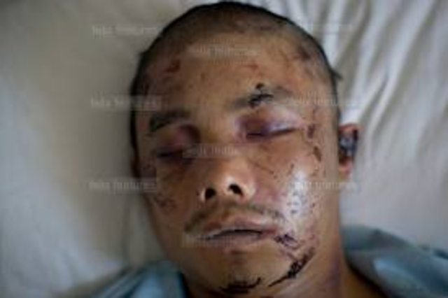 Getting mugged and beat up