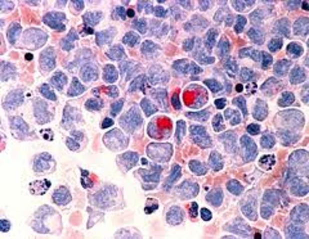 Se secuencia por primera vez el Génoma del Cáncer