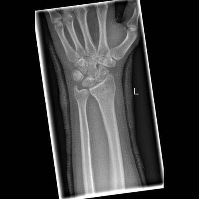 Timeline: History of the X-Ray