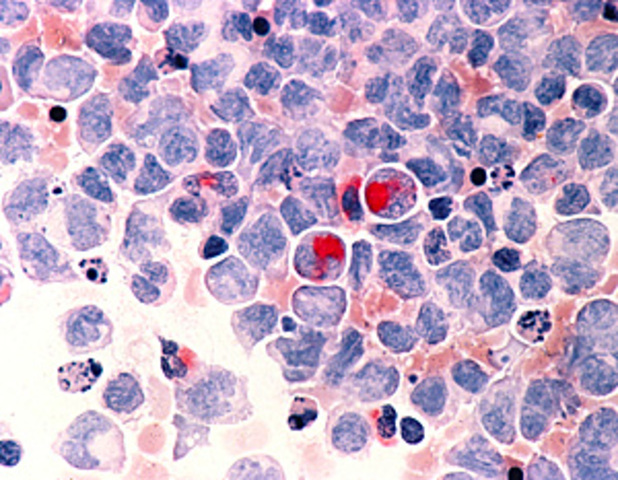 Se secuencia por primera vez el Génoma del Cáncer