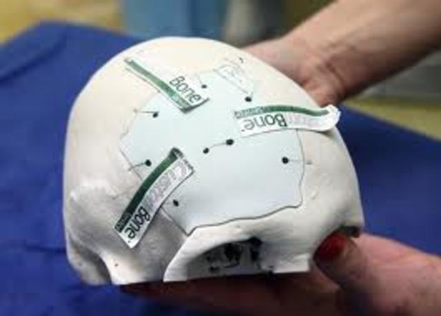 Hidroxiapatita (Biomaterial biocerámico)