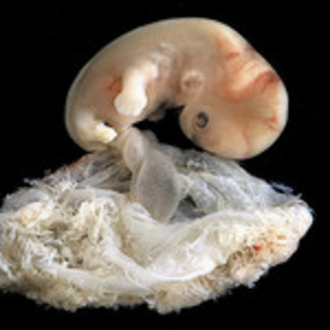 Prenatal-Embryonic Stage