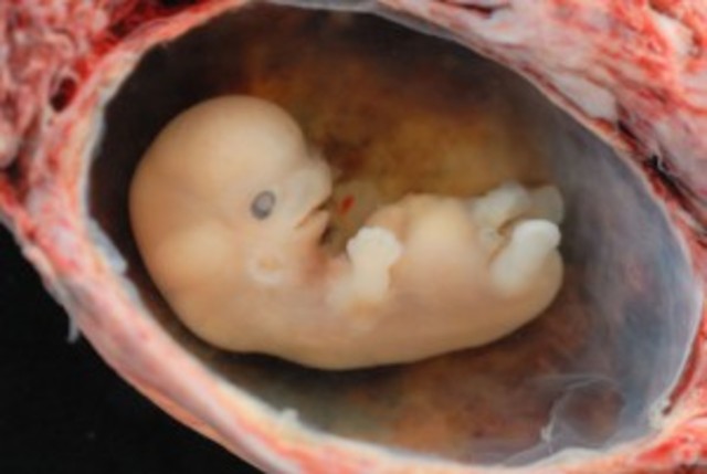 Embryonic Stage