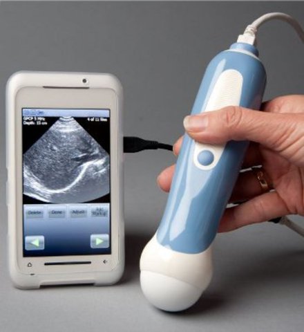Ultrasound is now on smart phones