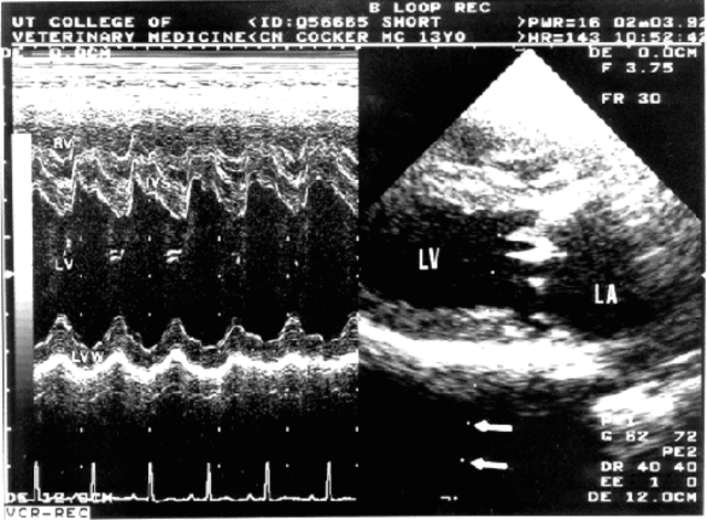 M-Mode Ultrasound