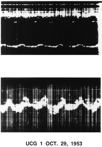 Development of Echocardiography