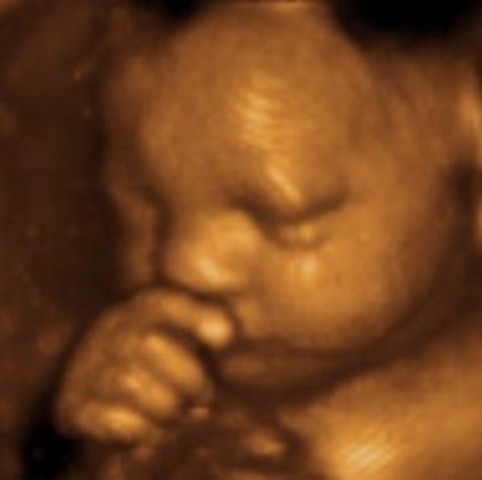 4D Ultrasound Video