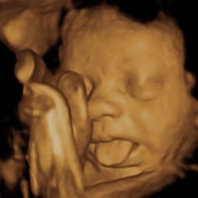 Timeline: History Of OB/GYN  Ultrasound