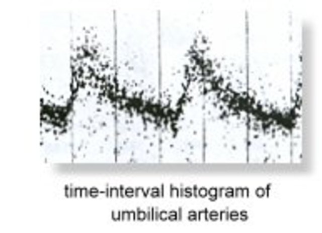 Development of Spectral Analysis