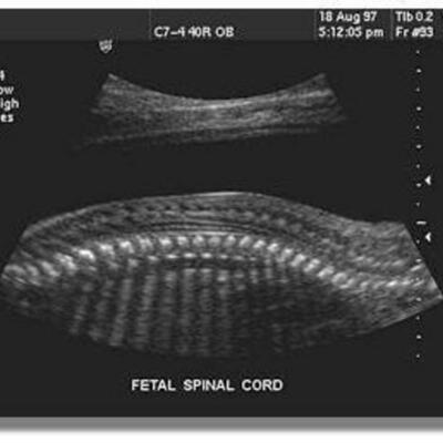 Timeline: History of Ultrasound