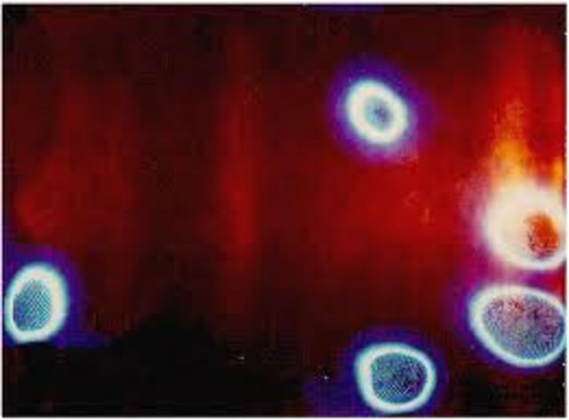 Se explica la fotosensibilidad