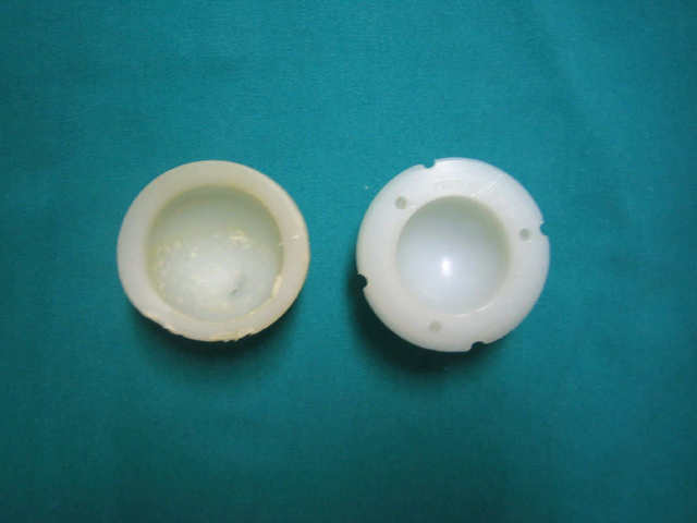 Primer trasplante de cadera.