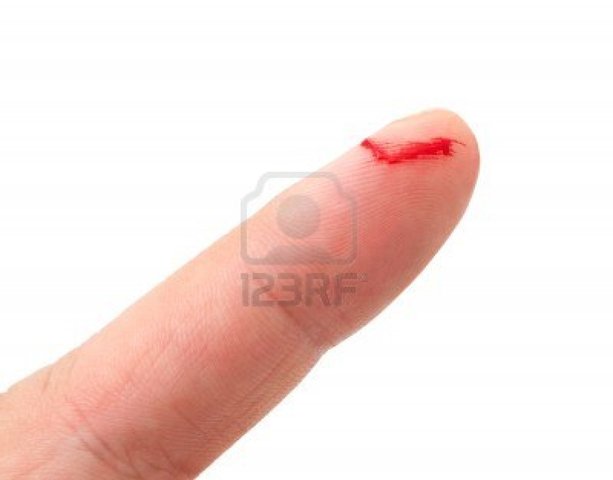 Me corte el dedo