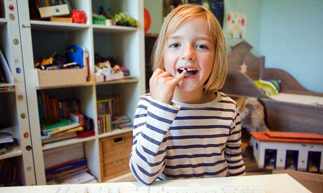 Middle Childhood -- Tooth Development