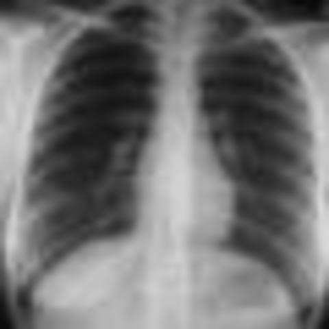 Wilhelm Roentgen 1895