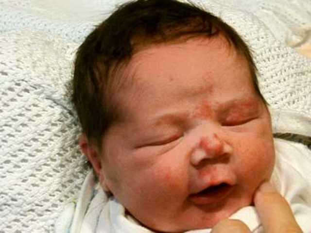 Fading of Rooting Reflex