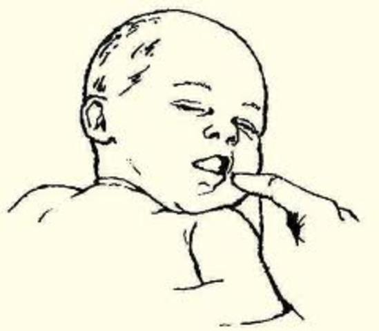 The Rooting Reflex Disappears