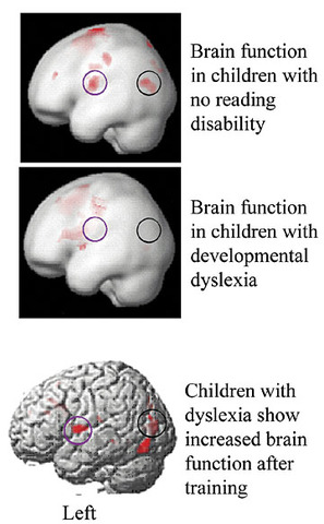 Neuroscientific Contributions
