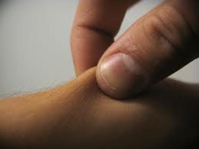 OUCH! St.patricks day.