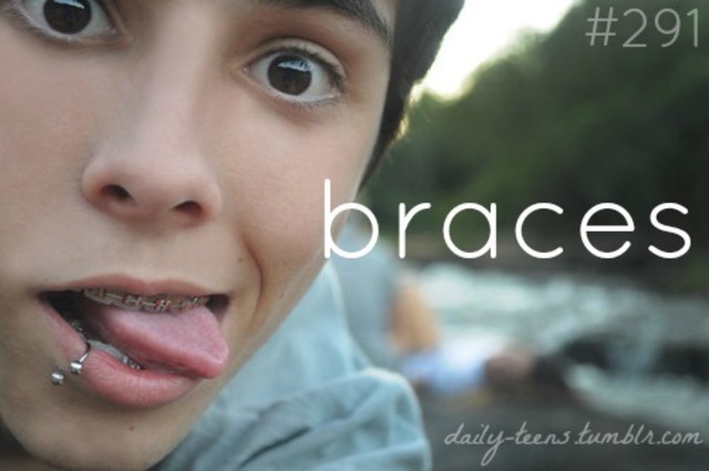 Braces :D