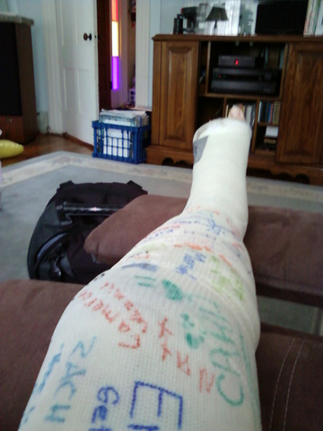 J'ai eu mon plâtre.