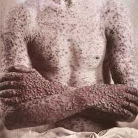 an epidemic of smallpox, brought by Europeans, kills many native Americans on the New England coast