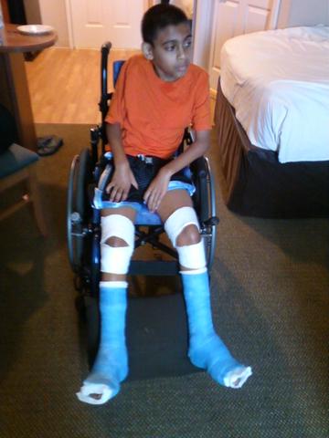 Mi hermano tuvó cirugía en ambos piernas.