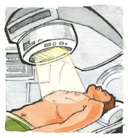 radiotherapy