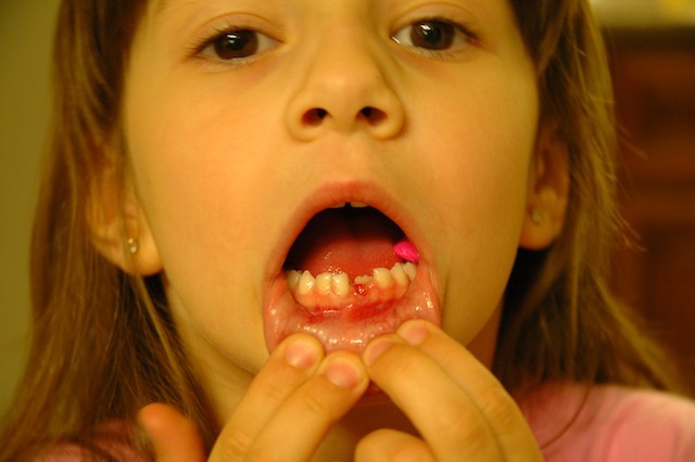 Lost My First Tooth