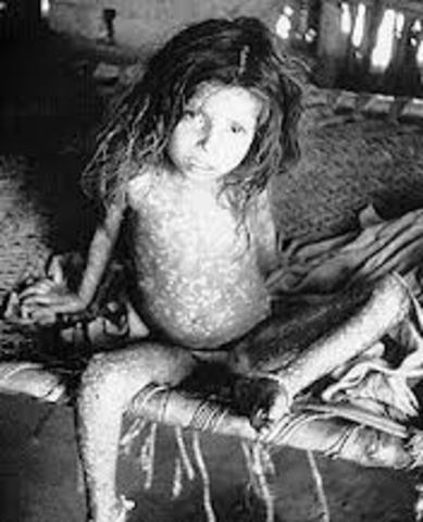 Epidemic of smallpox