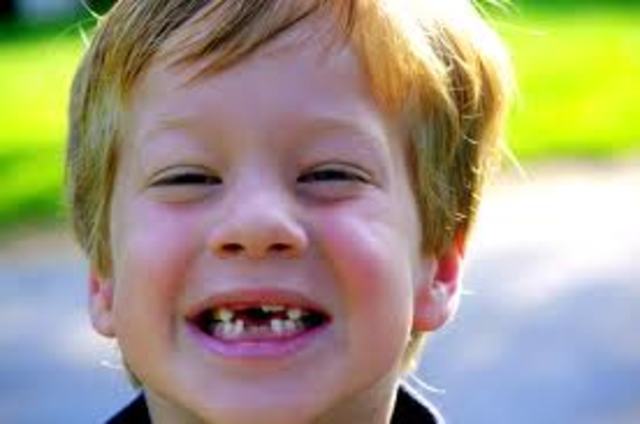 Lost my 1st tooth!(or teeth!)