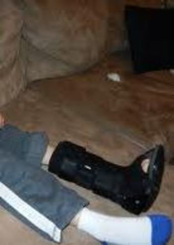 Me rompí el tobillo en dos mil y tres