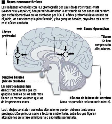 TRASTORNOS DE ANSIEDAD (parte dos)