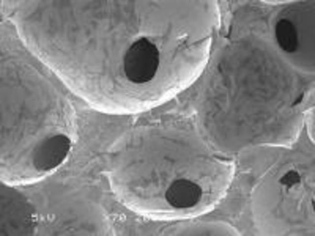 Vidrios bioactívos ( biomaterial ceramico)