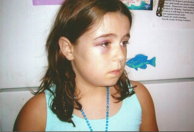 Mí primero ojo negro en viente y seis el mayo de dos mil ocho