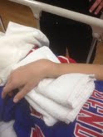 Mi primero hueso roto