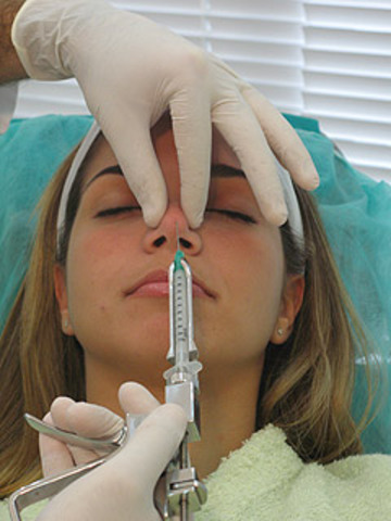 Polimetilmetacrilato