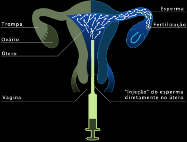 Inseminação Artificial